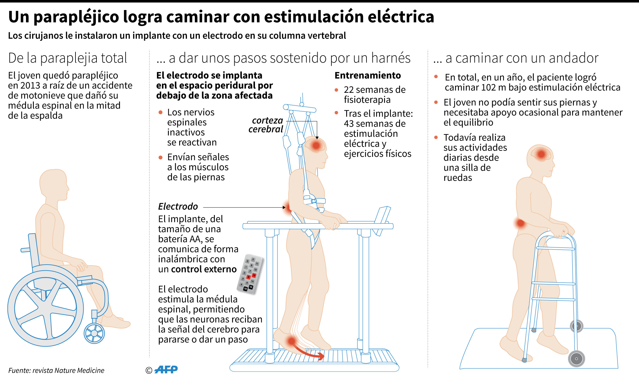 Parapléjico logra caminar gracias a la estimulación eléctrica