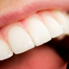 Una buena higiene dental puede prevenir enfermedades