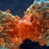 Diez cosas que debemos saber sobre el cáncer