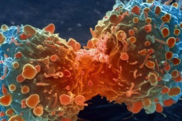 El cáncer es la segunda causa de muerte en América Latina