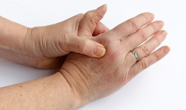 La Artritis Reumatoide aumenta como causa de ausentismo laboral