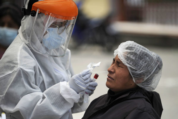 Descubren la proteína que podría estar causando la Covid-19 grave