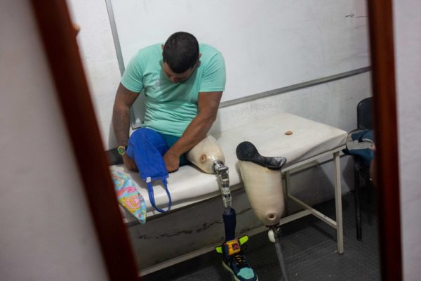 Amputados fabrican prótesis en Venezuela