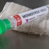 SVInfectología recomienda a las personas en situación de riesgo vacunarse contra la viruela del mono