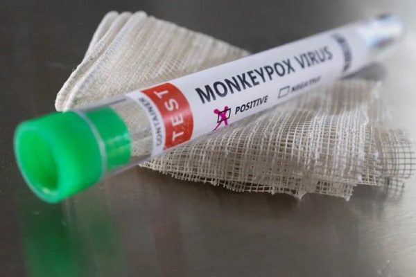 Brasil confirma primer caso de viruela del mono