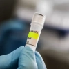Tres fallecidos por hantavirus en el noreste de Venezuela, informa Ministerio de Salud