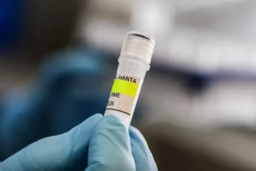 Tres fallecidos por hantavirus en el noreste de Venezuela, informa Ministerio de Salud