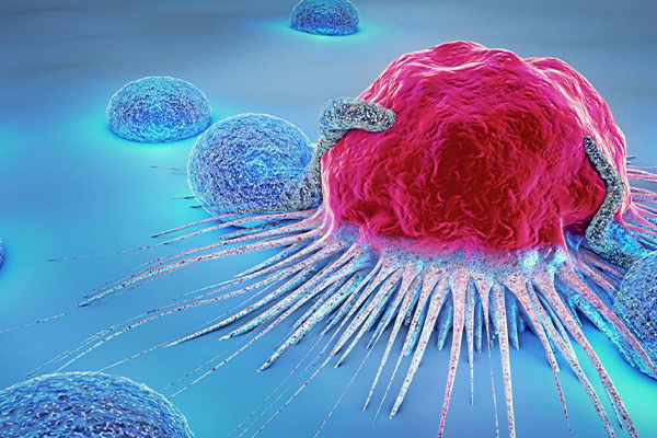 #Atenci&oacute;n: Aumento de c&aacute;ncer colorrectal en j&oacute;venes preocupa a la comunidad m&eacute;dica