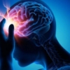 D&iacute;a Mundial del ACV: Reconocer s&iacute;ntomas de un Accidente Cerebrovascular a tiempo reduce secuelas graves